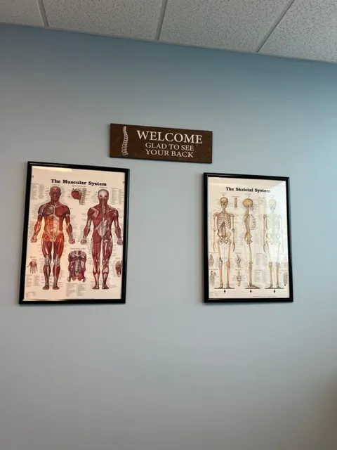 MyoCore - Irving Picture 4