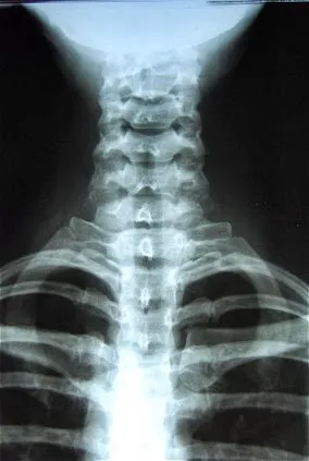 Colin Tkachuk, DC Picture 5