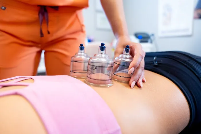 Dry Needling Method Picture 8