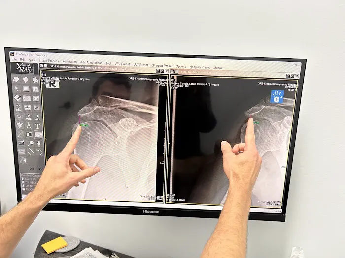 FreeForm Chiropractic - Frisco Chiropractor | Spinal Decompression, Muscle Therapy, Massage & Injury Rehab Picture 6