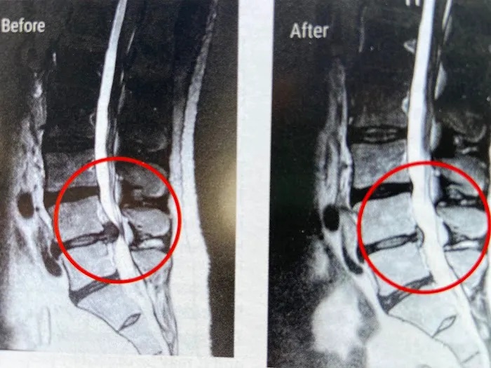 Frisco Spinal Rehabilitation Picture 2