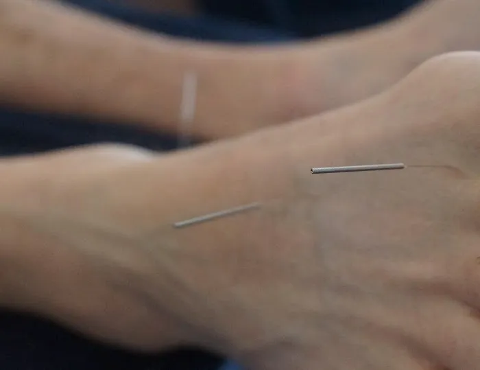 Dr. Heather Wright, DC, CCEP, Licensed in Acupuncture (NBCE) Picture 5