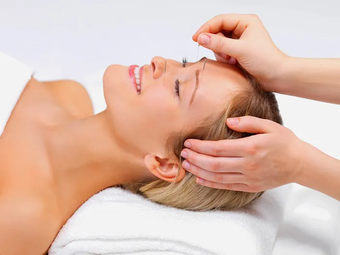 CA Acupuncture & Chiropractic Clinic Picture 10