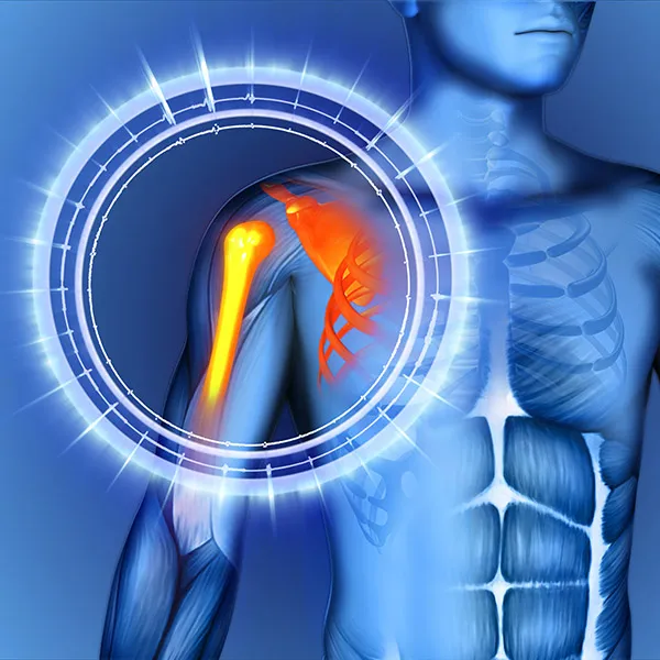 Accident and Injury Chiropractic Mesquite Picture 8