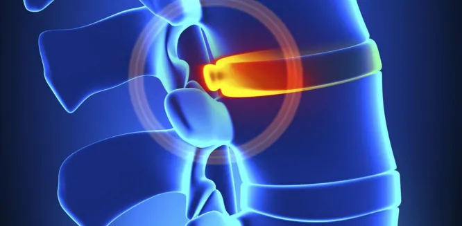 Champion Wellness Centers (formerly Palma Ceia Chiropractic and Wellness) Picture 10