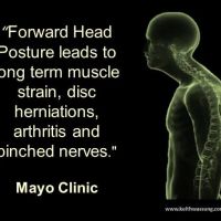 Upper Cervical of San Francisco | Dr. Ryan Lawlor ico