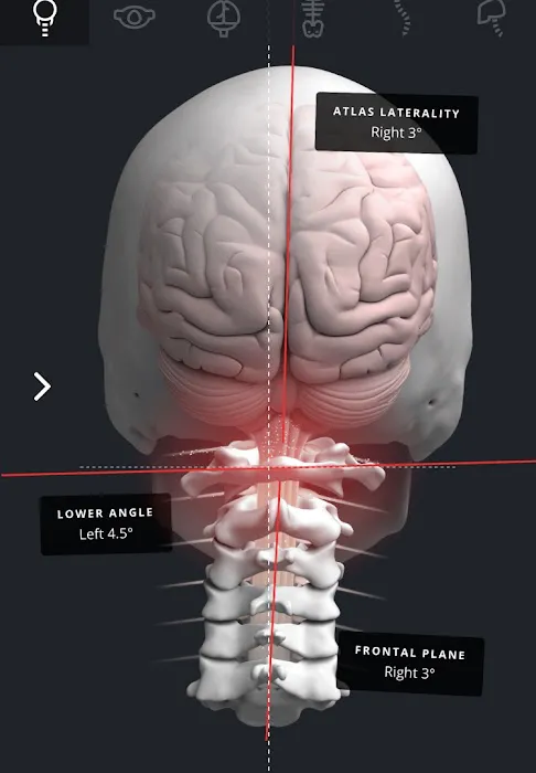 Align Spinal Care Picture 2