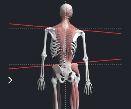 Align Spinal Care