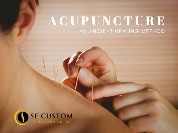 SF Custom Chiropractic - #1 Chiropractor Fisherman's Wharf Russian Hill Picture 10