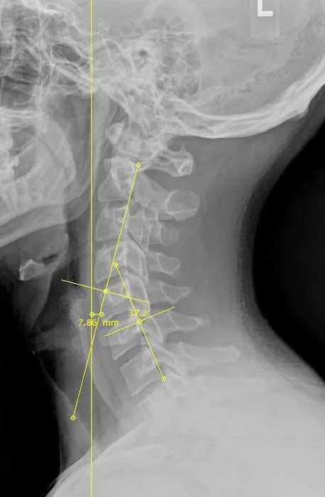 5280 Chiropractic Picture 6