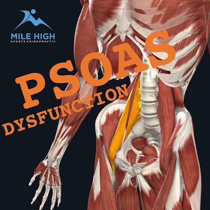 Mile High Sports Chiropractic Picture 5