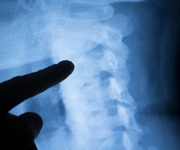 Brandon Baldwin Denver Chiropractor Picture 10