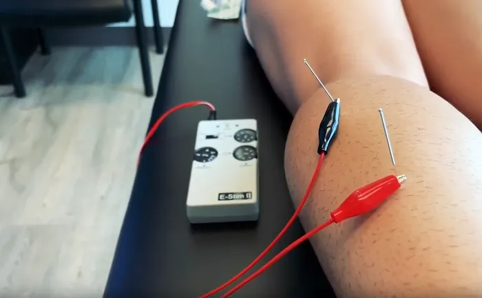 ESP Sports Medicine Picture 9