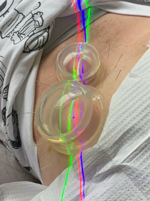 Cramer Chiropractic Acupuncture and Laser Center Picture 7