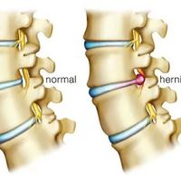 Boomerang Healthcare ico