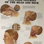 Gentle Chiropractic Care