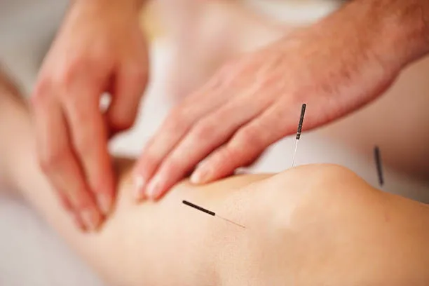 City Center Chiropractic, Acupuncture and Massage Picture 5