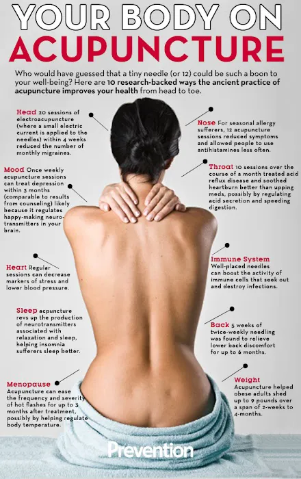 City Center Chiropractic, Acupuncture and Massage Picture 6