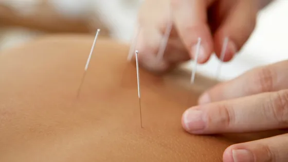 City Center Chiropractic, Acupuncture and Massage Picture 7