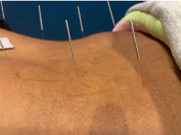 Juarez Chiropractic Picture 7
