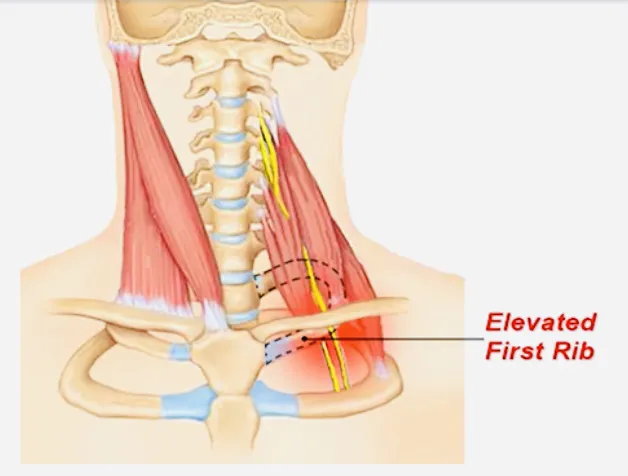 Excellence Chiropractic Picture 2