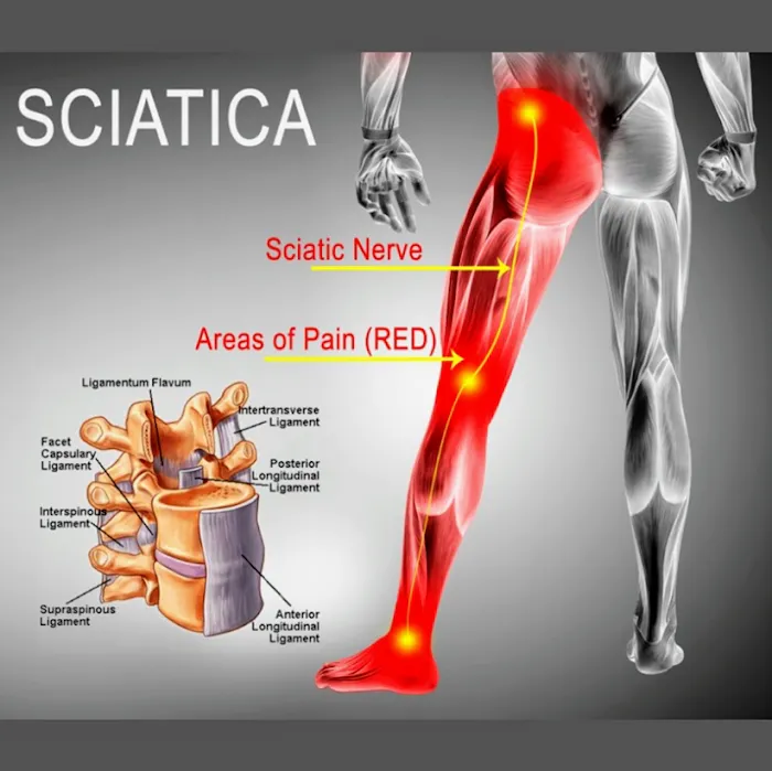 Excellence Chiropractic Picture 10