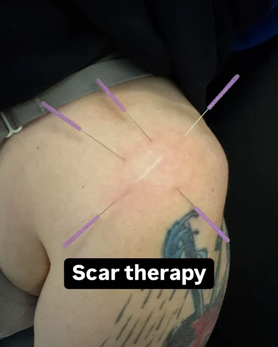 True Precision Rehab Picture 1