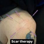 True Precision Rehab
