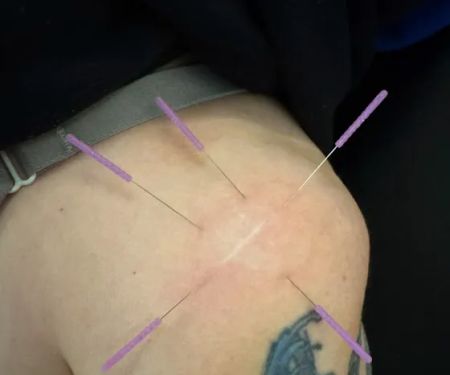 True Precision Rehab