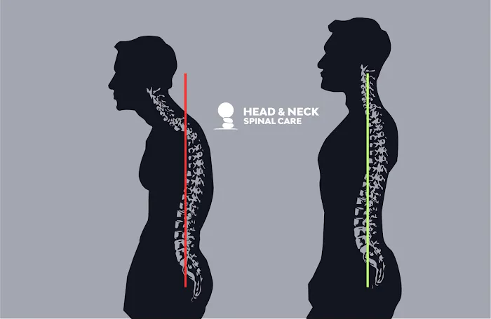 Head and Neck Spinal Care Picture 6