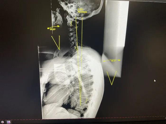 Spinal Health Center Picture 4