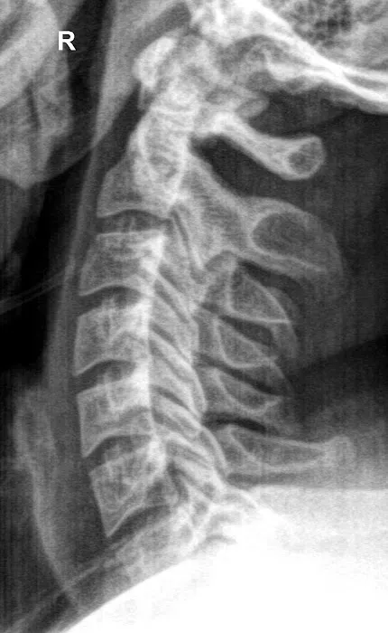Adjusted Health Picture 5