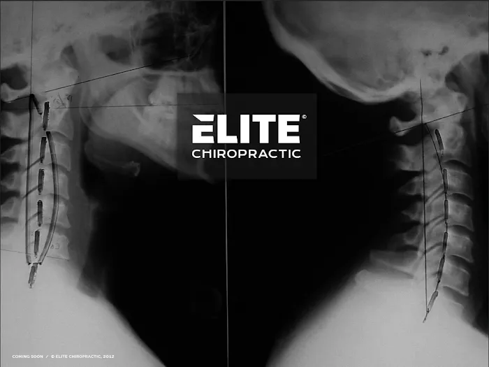 Elite Chiropractic Picture 3