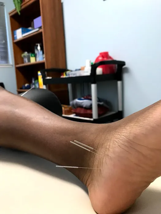 Dry Needle Pain Relief at Chanatry Chiropractic Picture 8