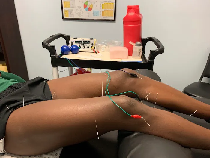 Dry Needle Pain Relief at Chanatry Chiropractic Picture 7
