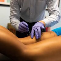 Dry Needle Pain Relief ico