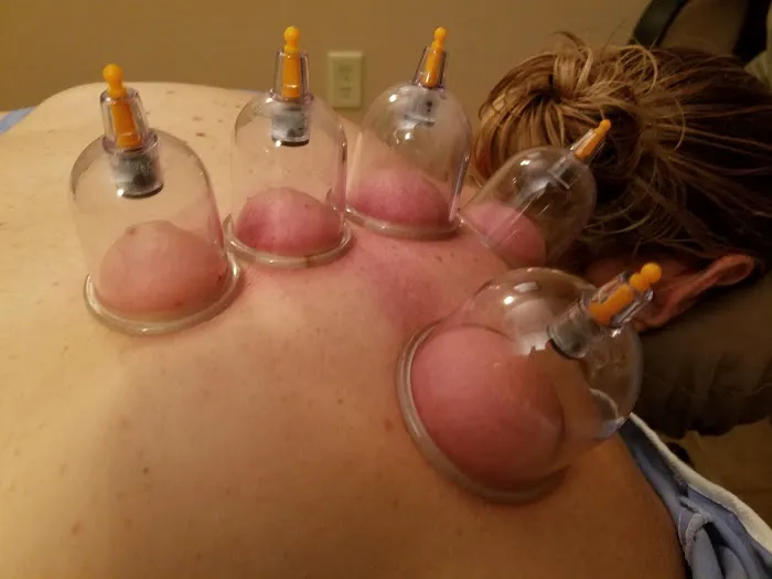Jacksonville Chiropractic & Acupuncture Picture 1