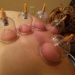 Jacksonville Chiropractic & Acupuncture