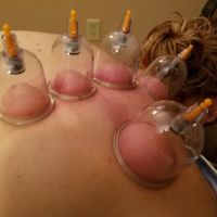 Jacksonville Chiropractic & Acupuncture ico