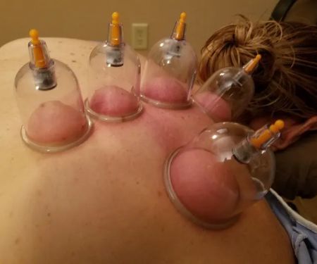 Jacksonville Chiropractic & Acupuncture