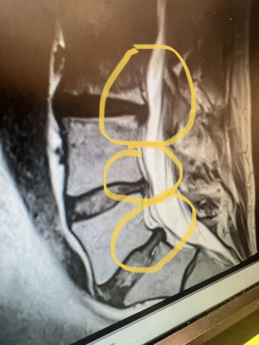 Amazing Spine Care Picture 7