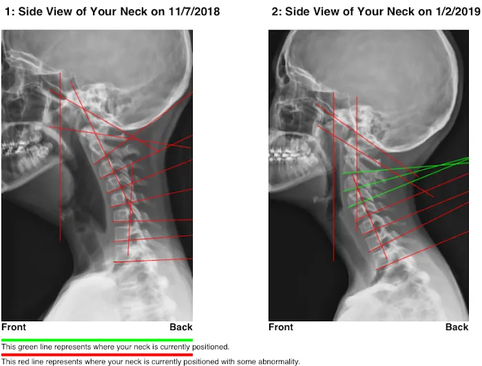 Hartley Chiropractic and Scoliosis Center in St. Augustine FL Picture 1