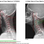 Hartley Chiropractic and Scoliosis Center in St. Augustine FL