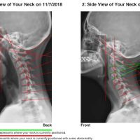 Hartley Chiropractic and Scoliosis Center in St. Augustine FL ico