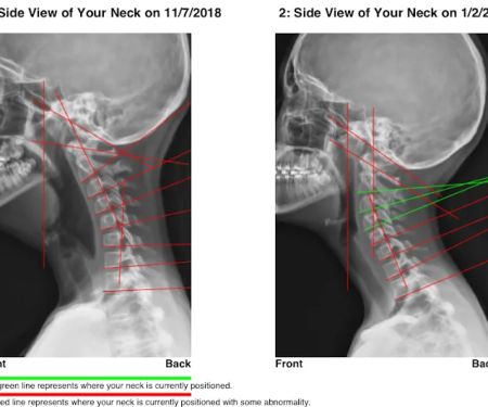 Hartley Chiropractic and Scoliosis Center in St. Augustine FL