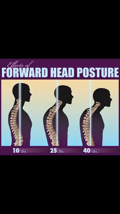 MotionLife Chiropractic & Acupuncture Picture 2