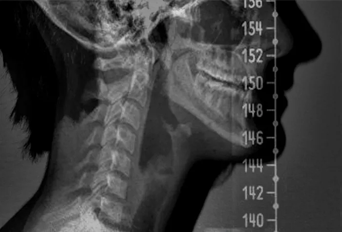 Poiema Chiropractic Picture 6
