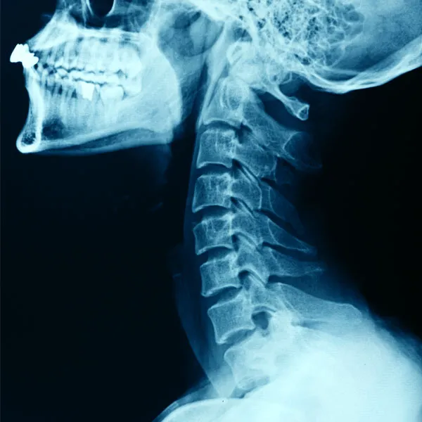 Hagen Chiropractic Center Picture 5