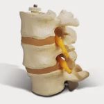 Everett Chiropractic Center