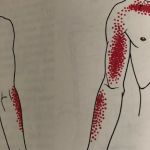 No Crack Chiropractor